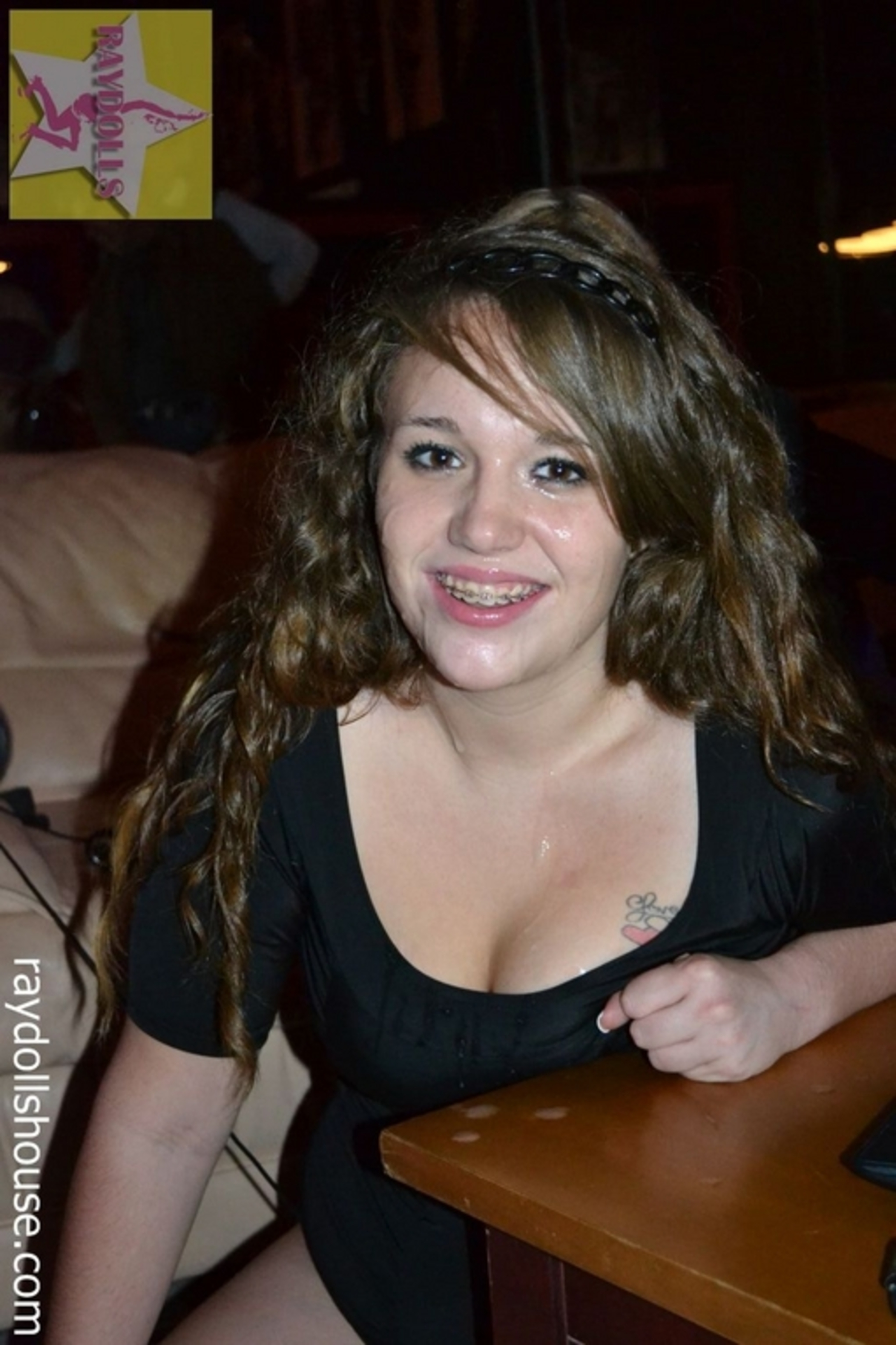 Braces! — 5