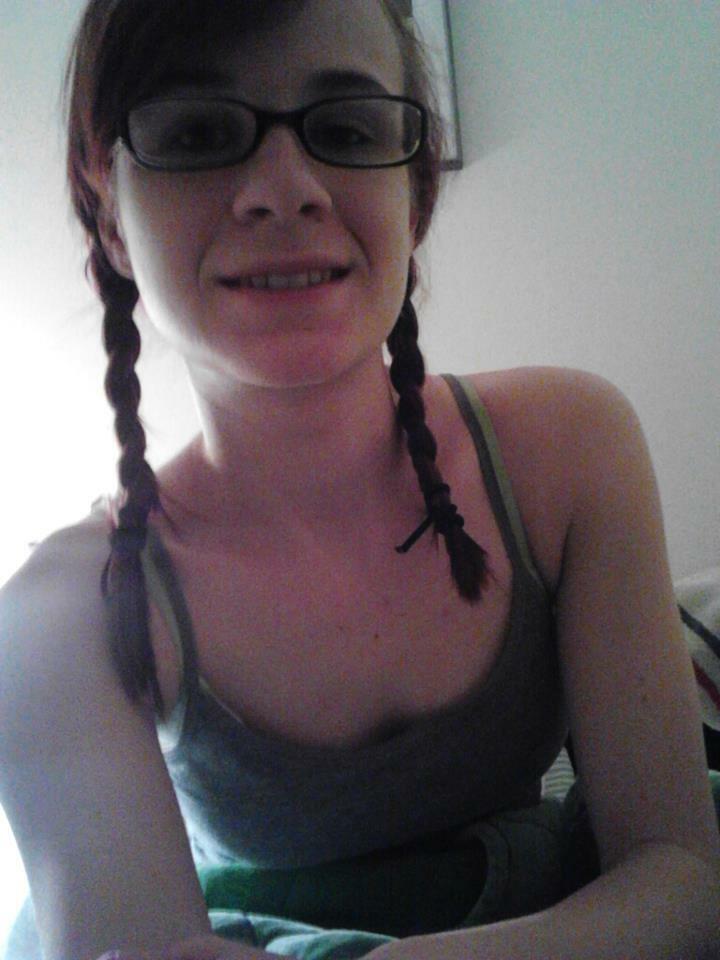 Braces — 23