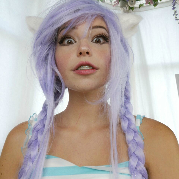 Braces — 19