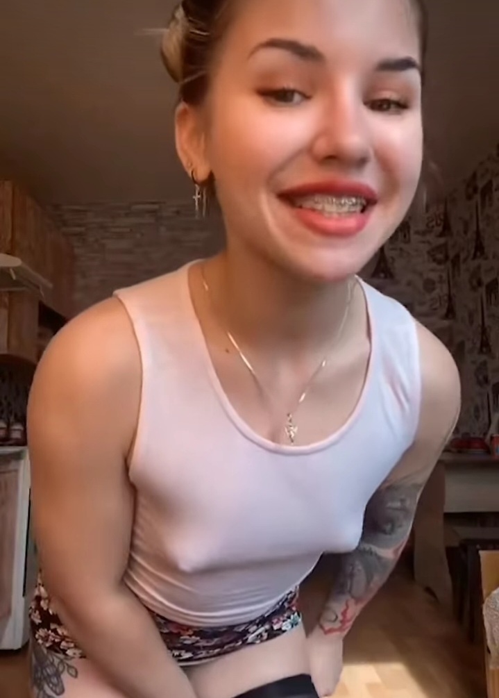 Braces! — 31