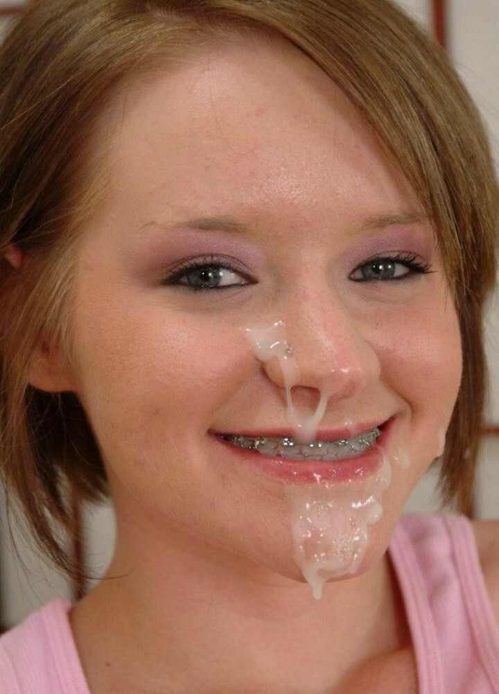 Braces! — 43