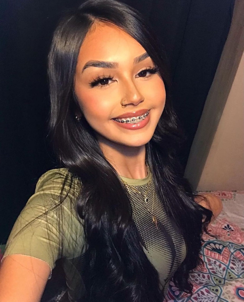 Braces — 15