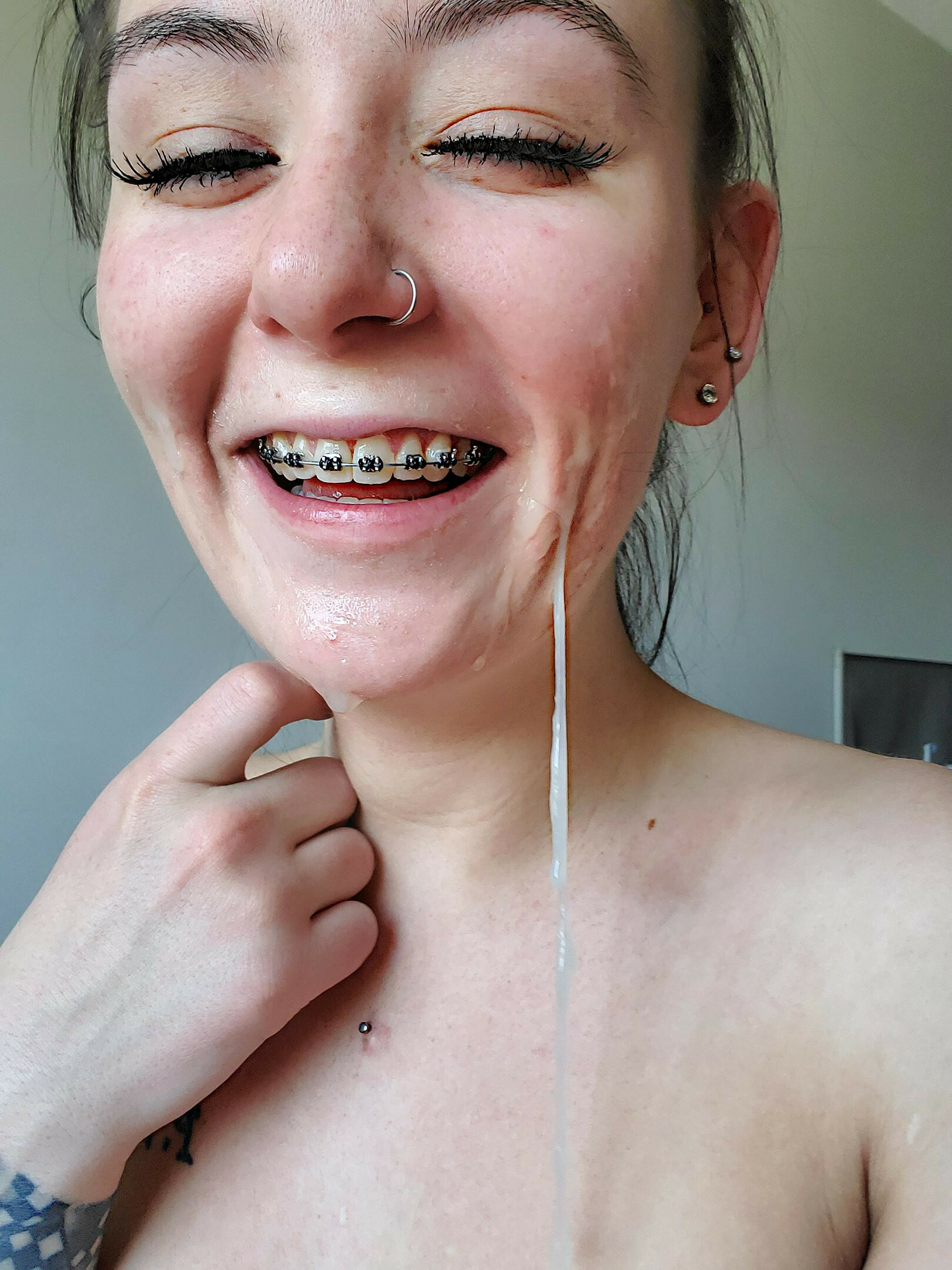 Braces! — 36