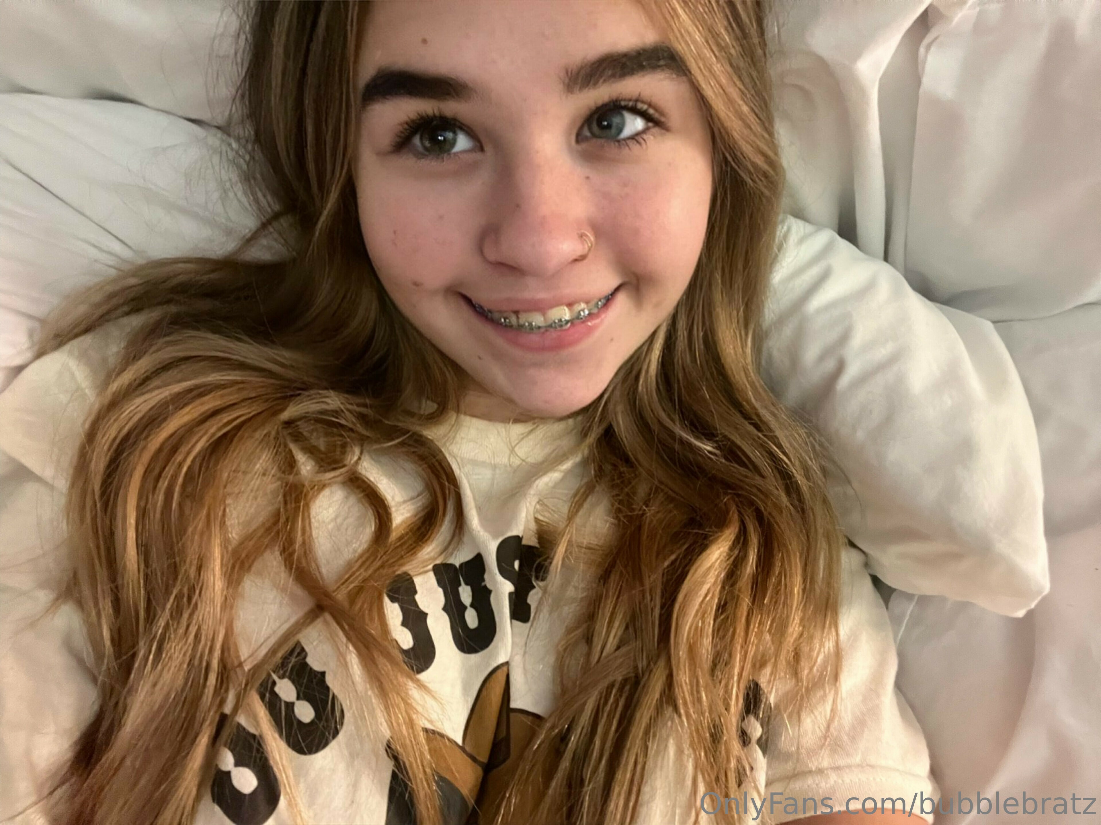Braces! — 42
