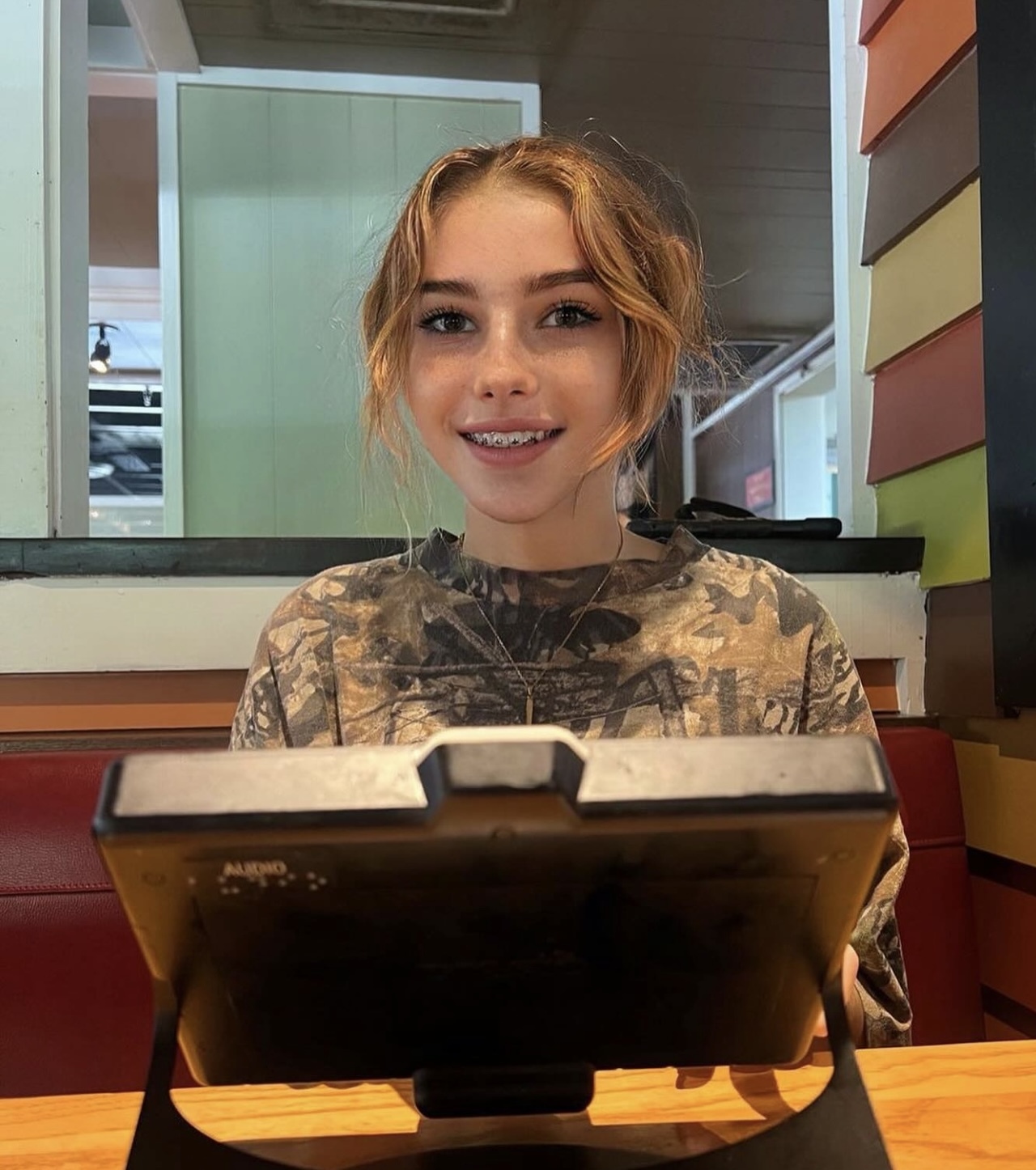 Braces — 11