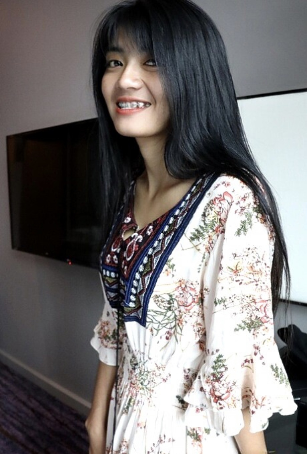 Braces — 7