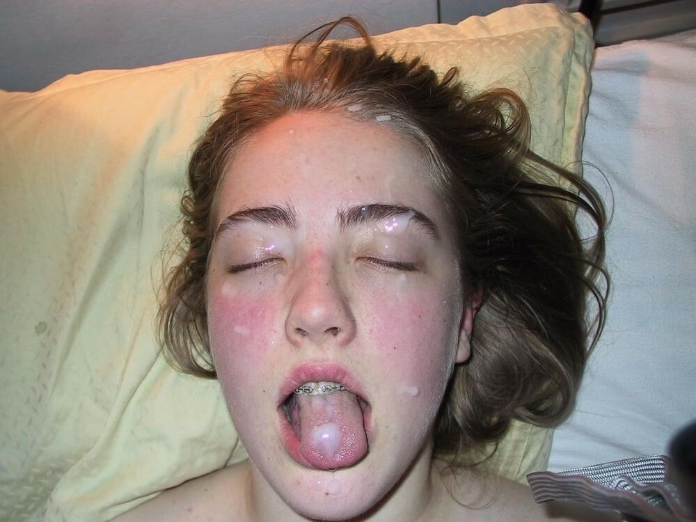 Braces! — 25