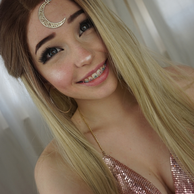 Braces — 21